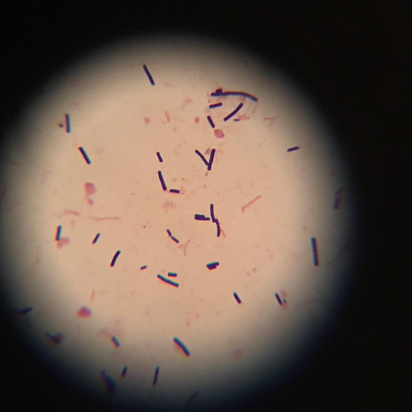 AmScope T490B Compound Trinocular Microscope, 40X-2000X Magnification, Halogen Light, Abbe Condenser, 2-Layer Mechanical Stage, High-Resolution Optics, Awarded No. 6 Among The Top 10 Microscopes 2016 - Customer Photo 2
