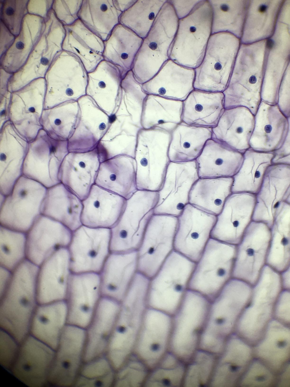 SWIFT SW350B 40X-2500X Magnification, Siedentopf Binocular Head, Research-Grade Compound Lab Microscope with Wide-Field 10X and 25X Eyepieces, Mechanical Stage, Abbe Condenser - Customer Photo 1