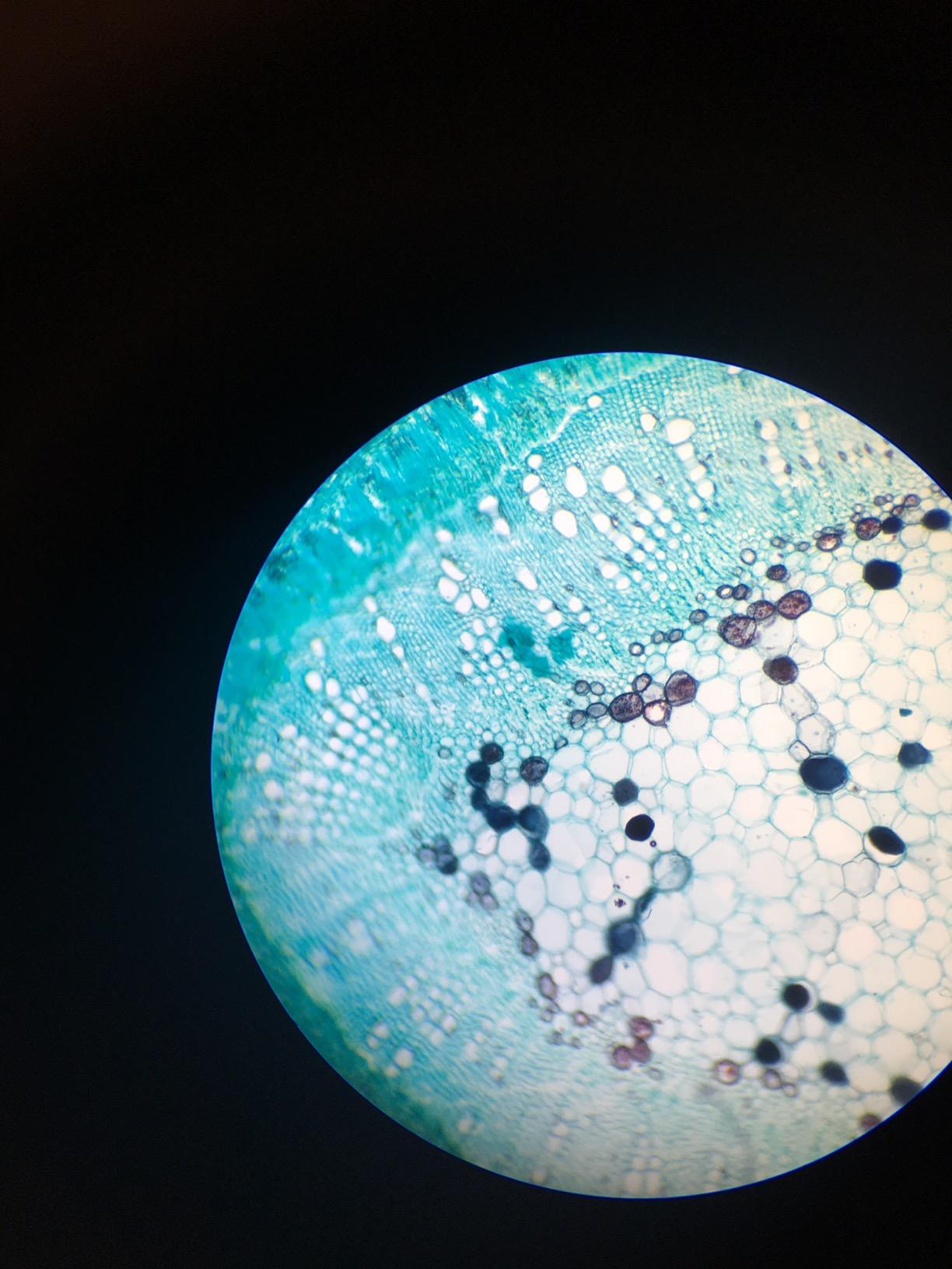 SWIFT SW350B 40X-2500X Magnification, Siedentopf Binocular Head, Research-Grade Compound Lab Microscope with Wide-Field 10X and 25X Eyepieces, Mechanical Stage, Abbe Condenser - Customer Photo 2